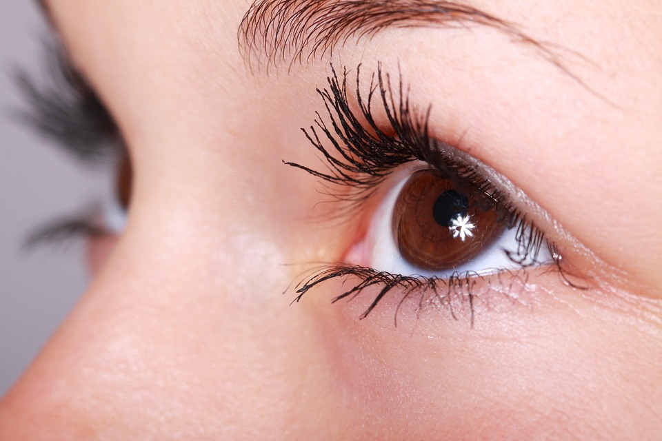 vitiligo eyelashes