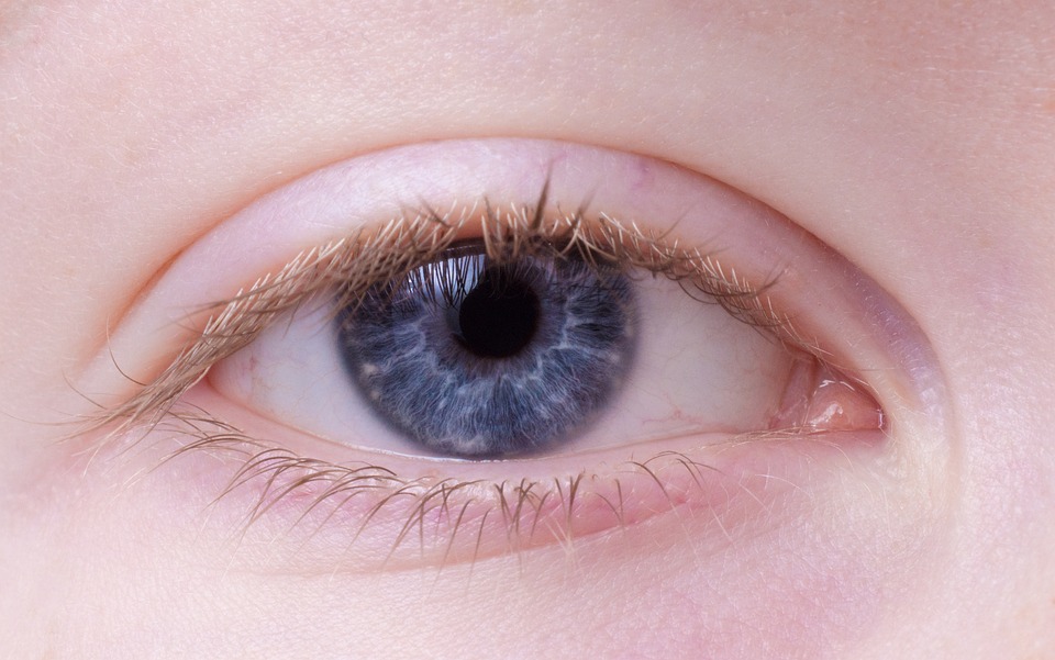 vitiligo eyelashes loss